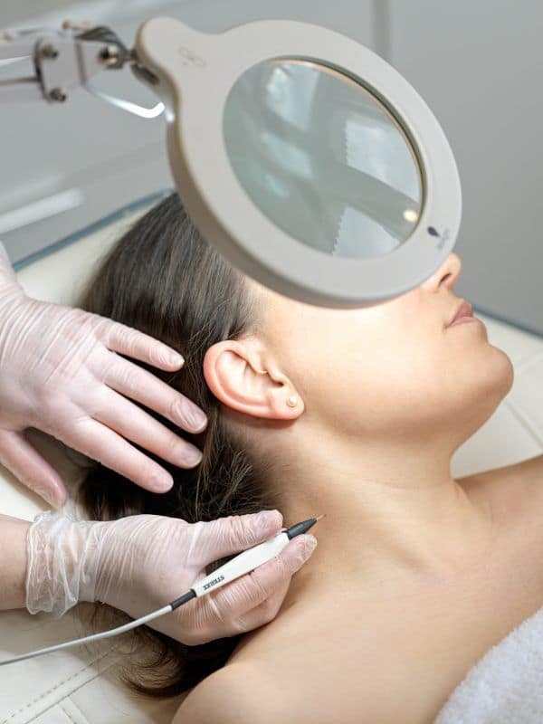 Electrolysis