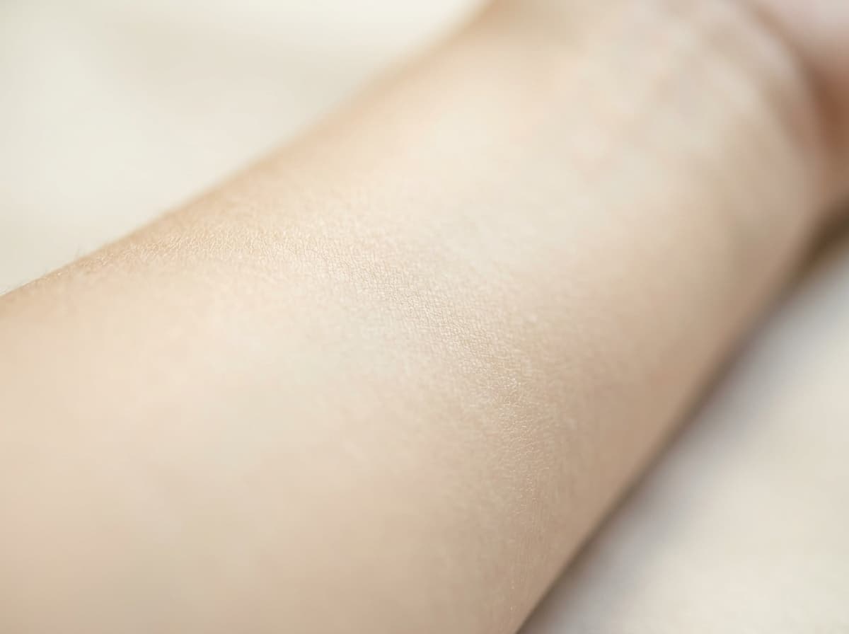Laser Hair Removal treatment at Diamond Laser Centre Mauritius